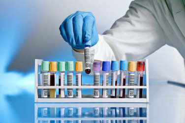 Pathology & Blood Test Laboratory